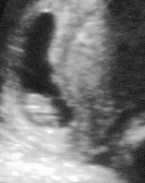 baby ultrasound images - week 7