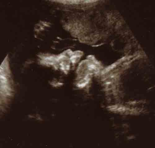 baby ultrasound images - week 25